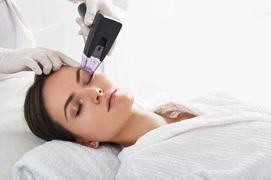 Radiofrequency microneedling handpiece applied to a client’s forehead during a treatment session